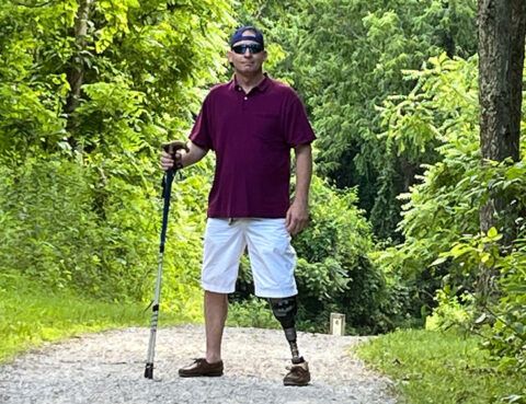 A man with a leg cast and a cane on the side of a road.